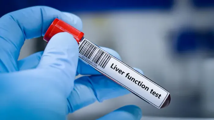 Guide to Liver Function Test